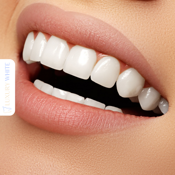 Hoe Krijg Ik Wittere Tanden? Top Oplossingen voor Stralend Witte Tanden
